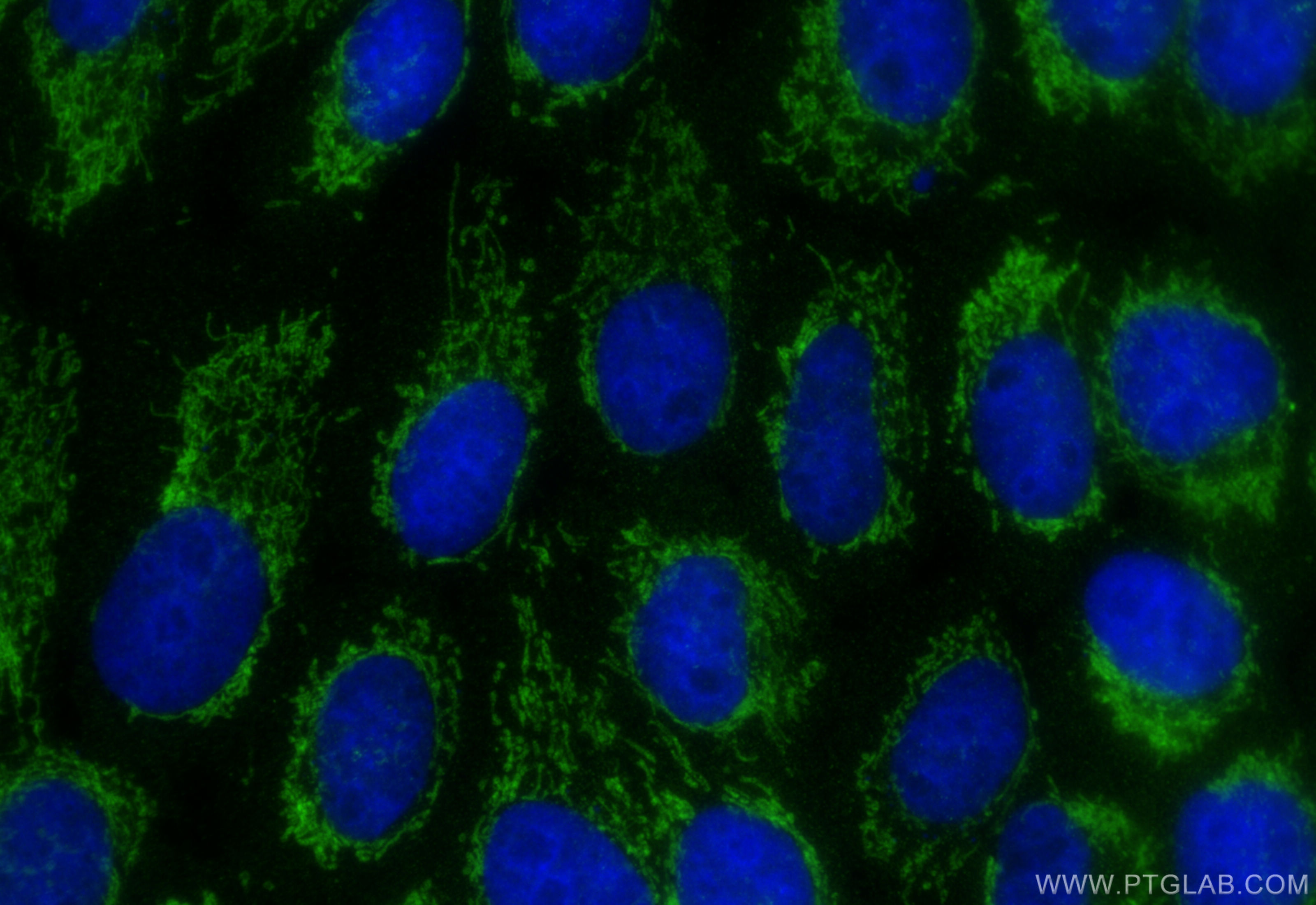 IF Staining of A431 using 12357-2-AP