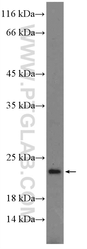 WB analysis of mouse spleen using 25028-1-AP