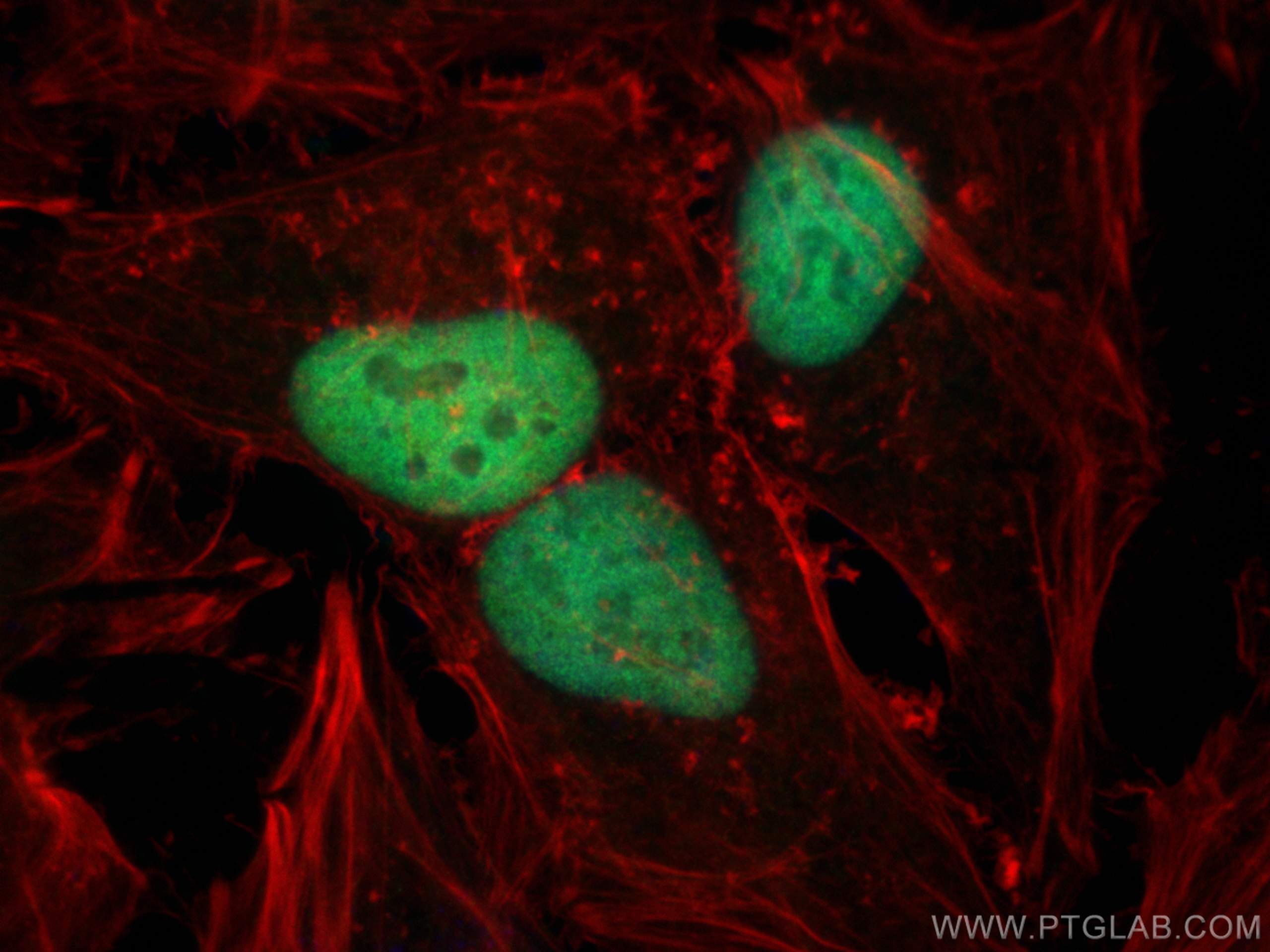 IF Staining of HeLa using 15520-1-AP