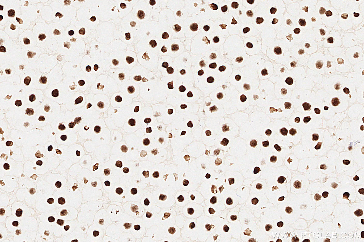 IHC staining of Ramos using 60161-1-Ig (same clone as 60161-1-PBS)