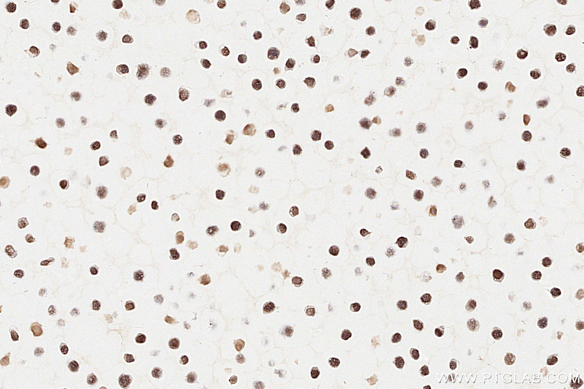 IHC staining of Ramos using 60161-2-Ig (same clone as 60161-2-PBS)