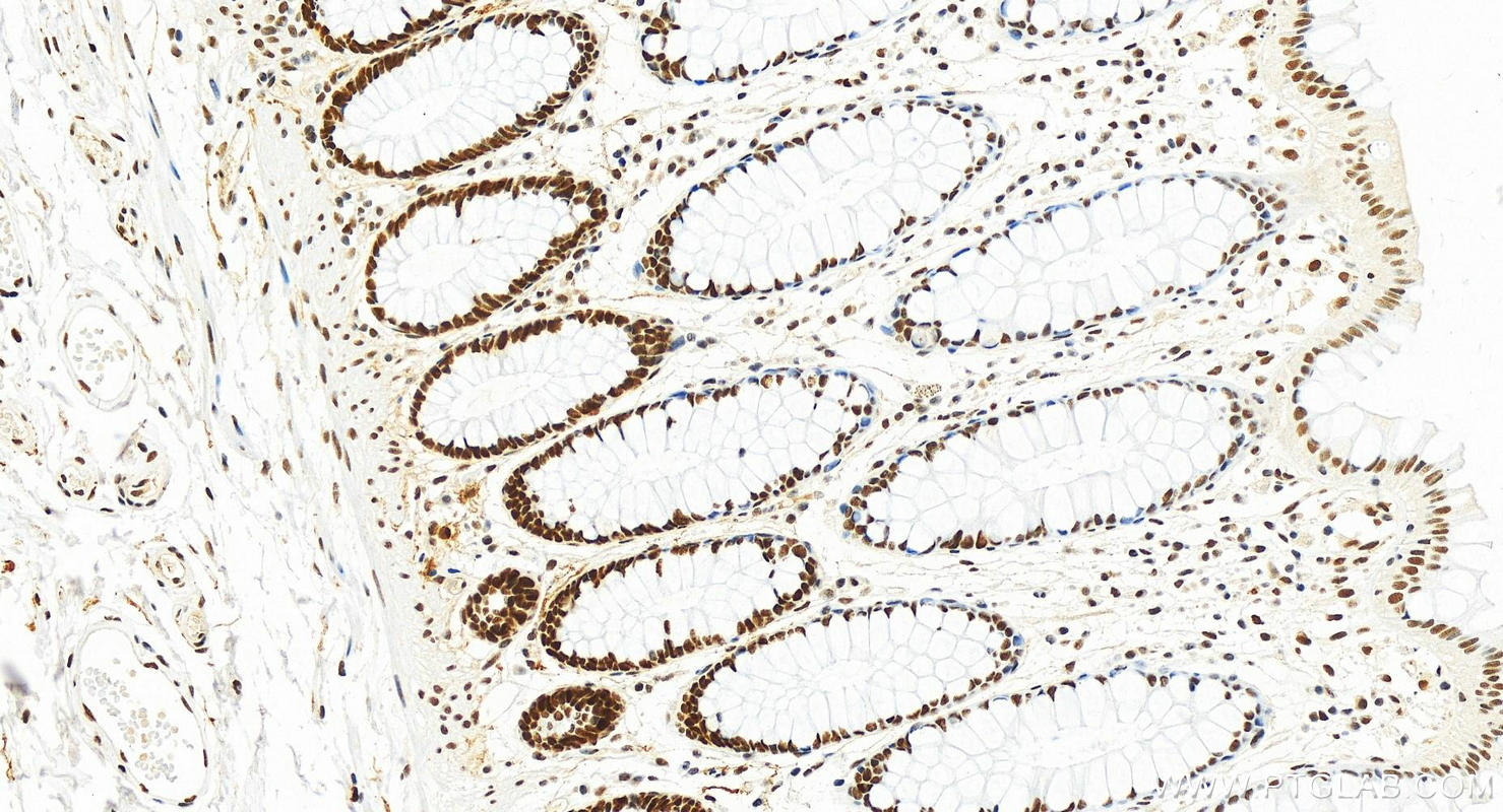 IHC staining of human colon using 82775-1-RR (same clone as 82775-1-PBS)