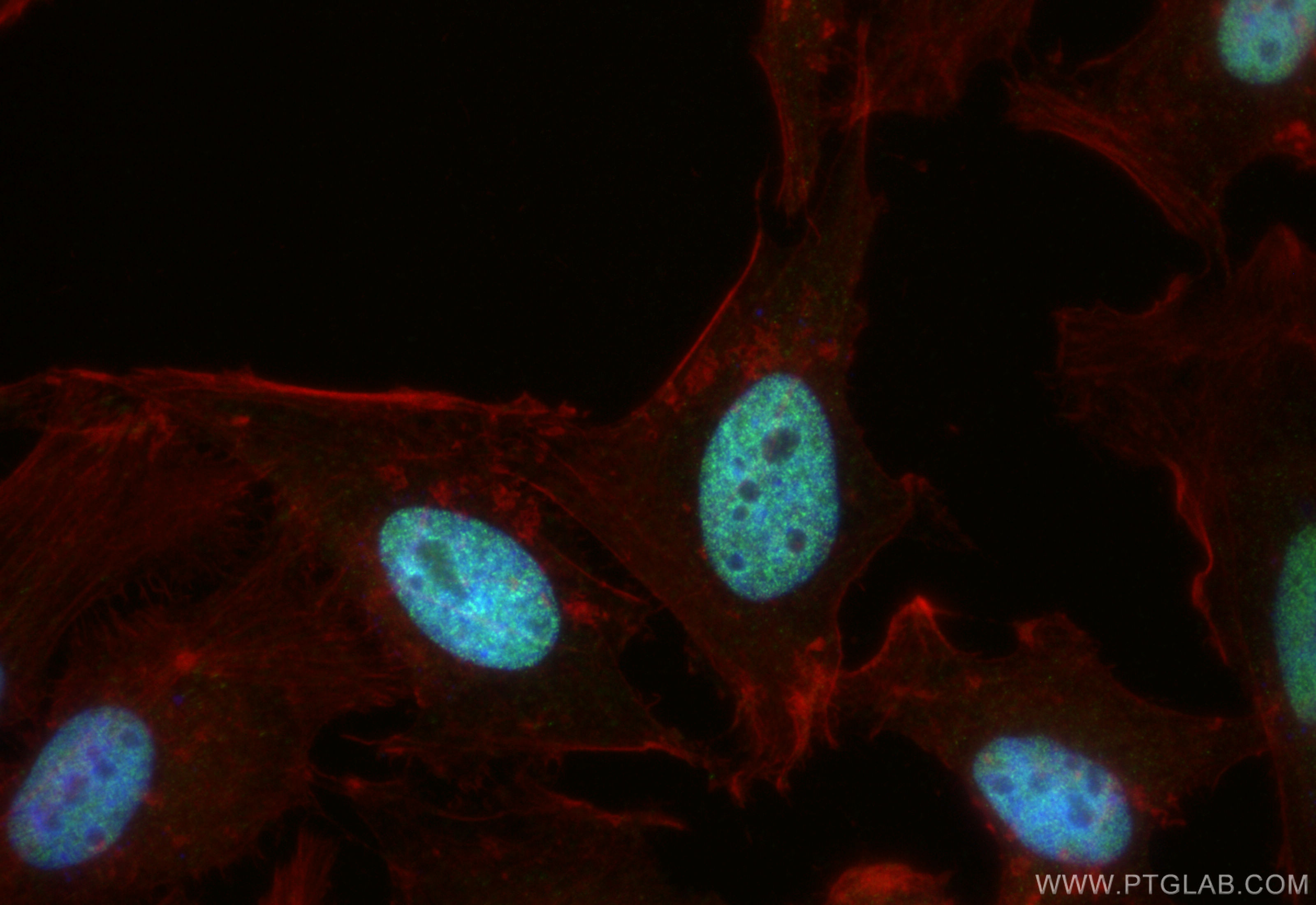 IF Staining of HeLa using 18120-1-AP