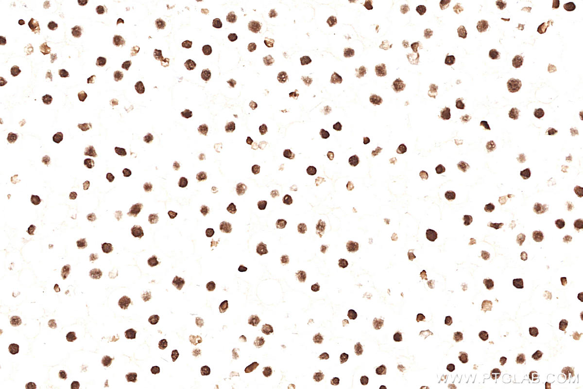 IHC staining of Ramos using 66172-1-Ig (same clone as 66172-1-PBS)