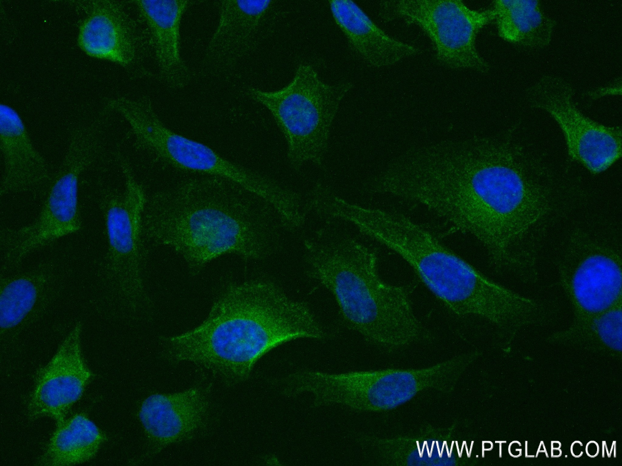 IF Staining of HeLa using 83744-2-RR