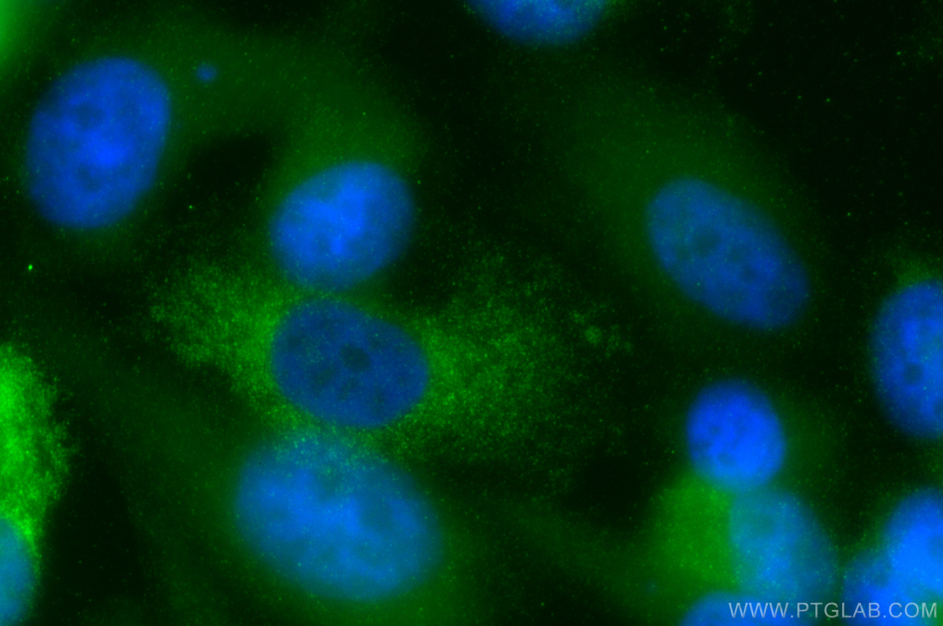 IF Staining of PC-3 using 19526-1-AP