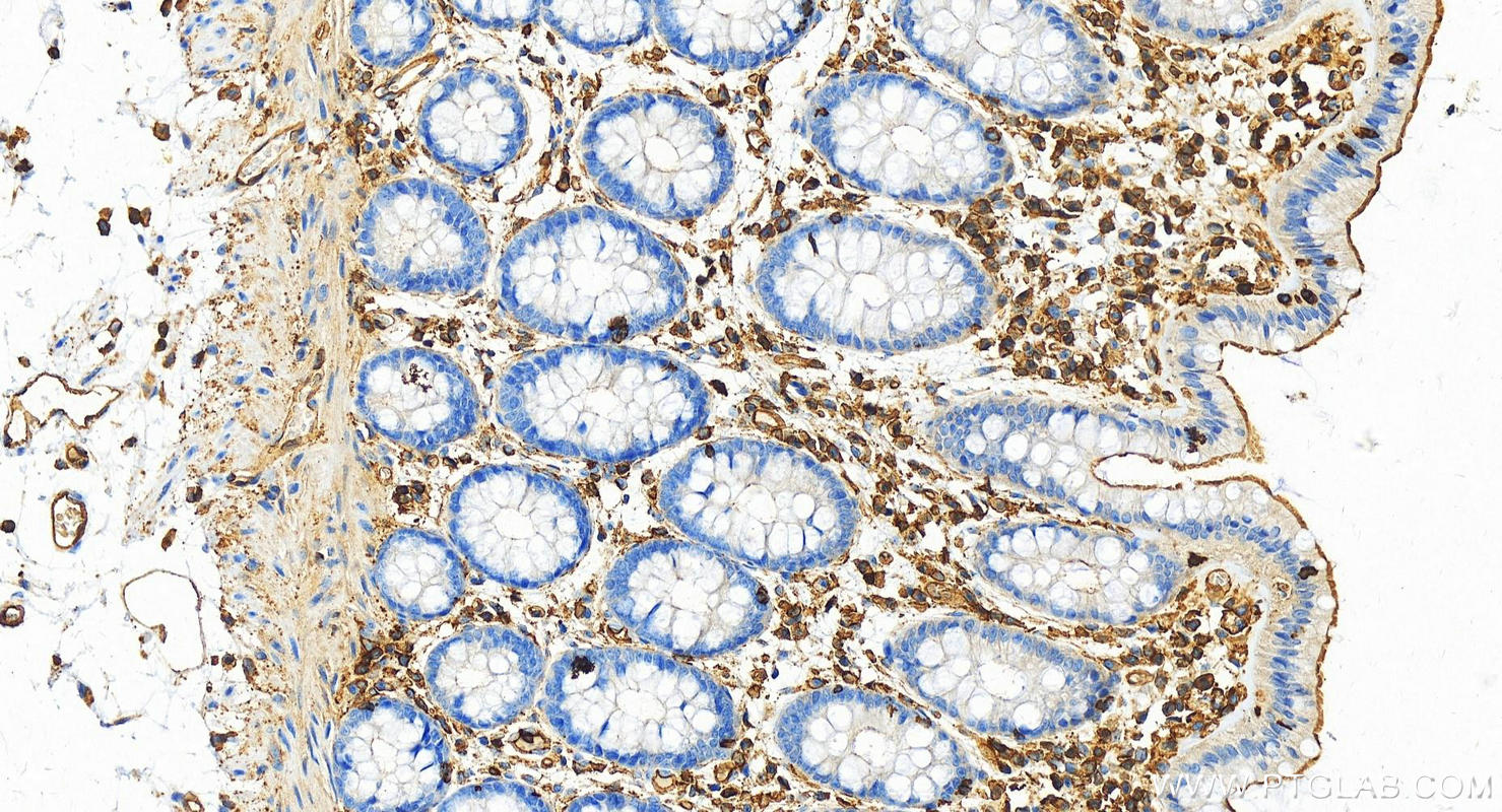 IHC staining of human  colon using 16495-1-AP