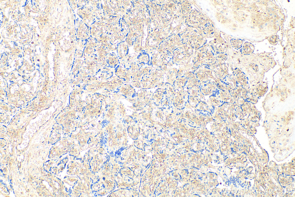 IHC staining of human placenta using 16495-1-AP