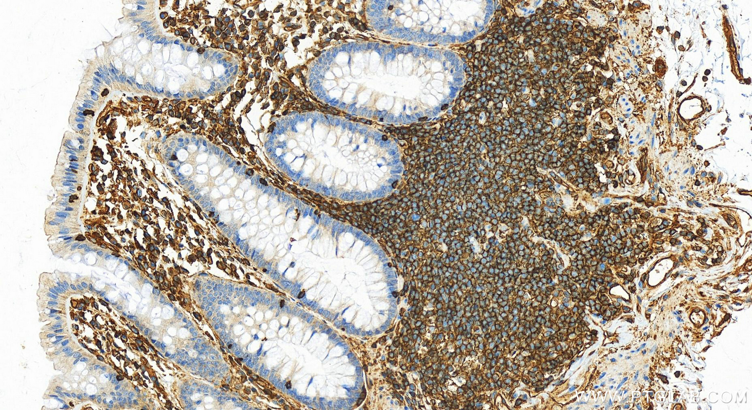 IHC staining of human colon using 26053-1-AP