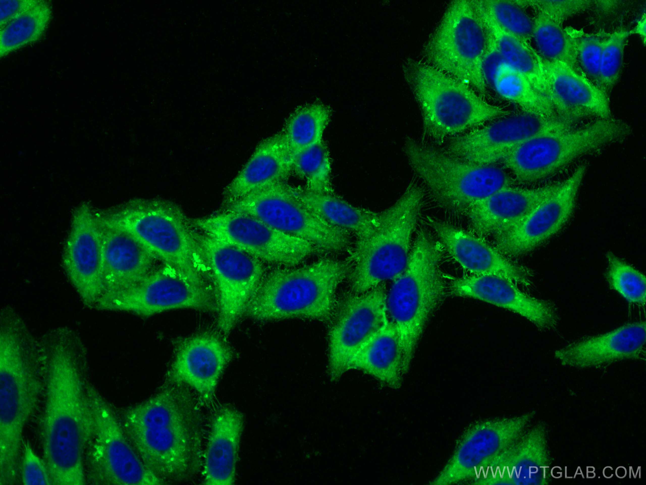 IF Staining of HepG2 using 26053-1-AP