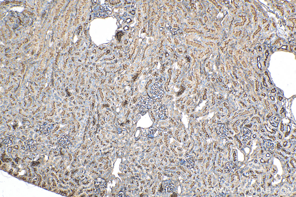 IHC staining of mouse kidney using 82009-1-RR (same clone as 82009-1-PBS)