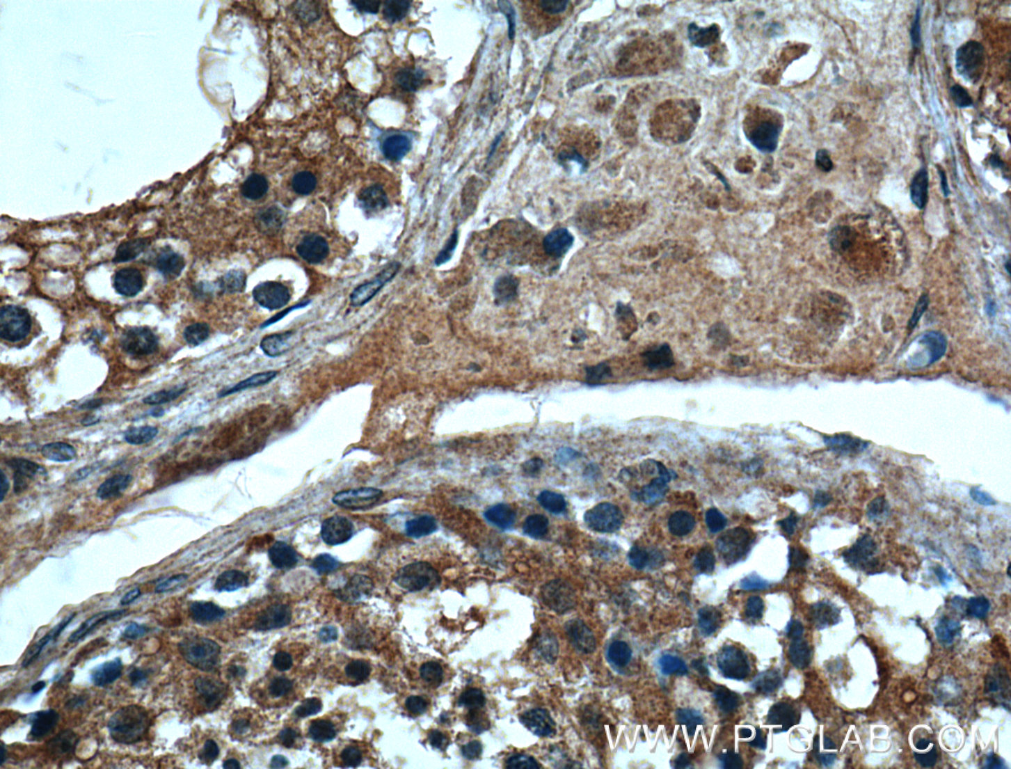 IHC staining of human testis using 14251-1-AP