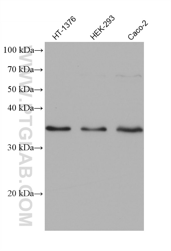 WB analysis using 68550-1-Ig (same clone as 68550-1-PBS)