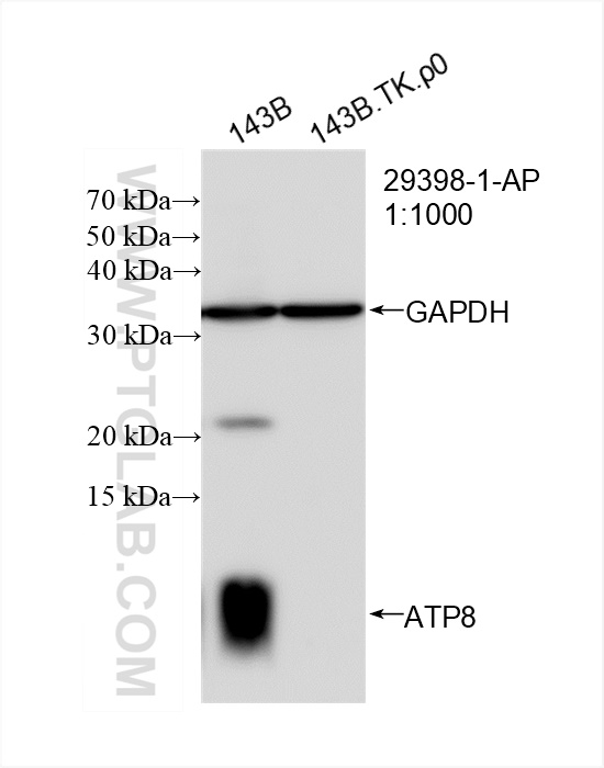 WB analysis of 143B.TK.P0 using 29398-1-AP