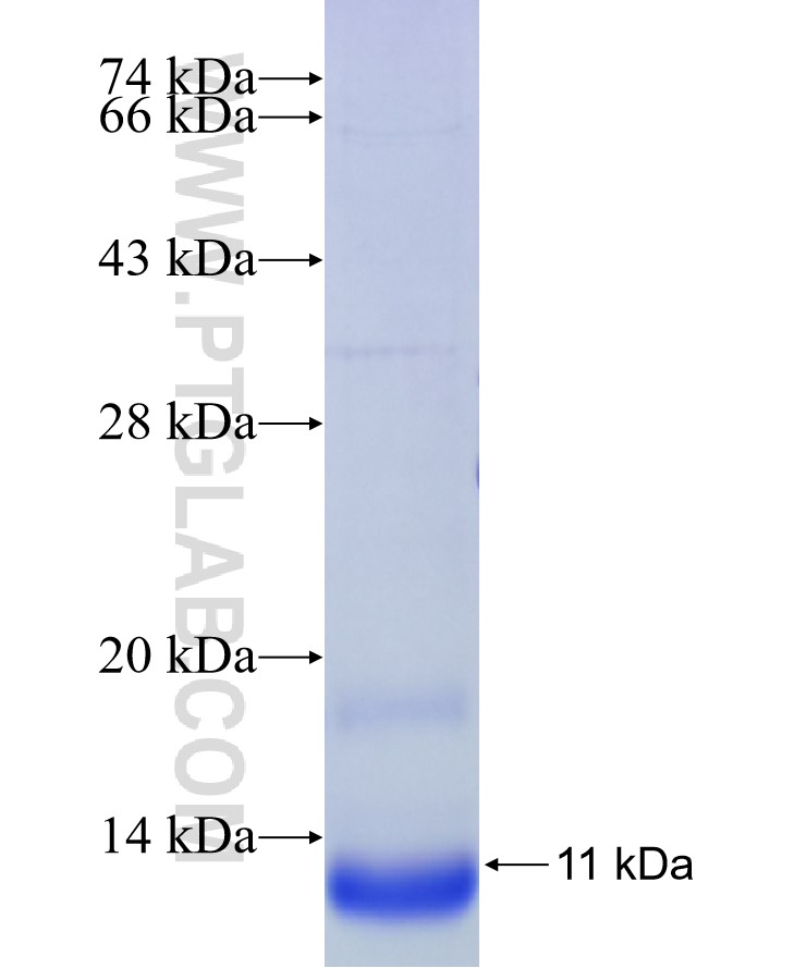 MT1X fusion protein Ag10940 SDS-PAGE