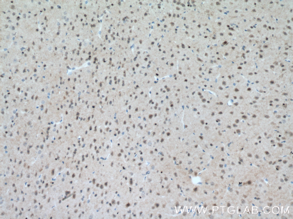 IHC staining of mouse brain using 12179-1-AP