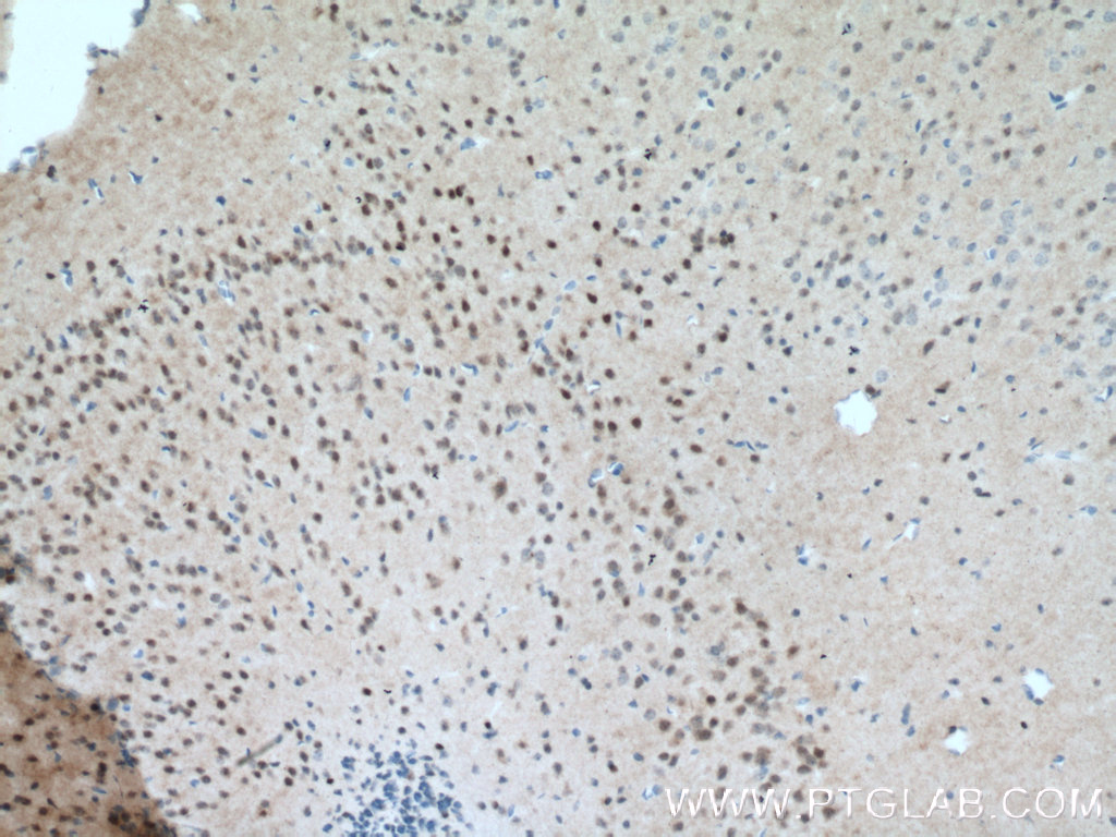 IHC staining of mouse brain using 12179-1-AP