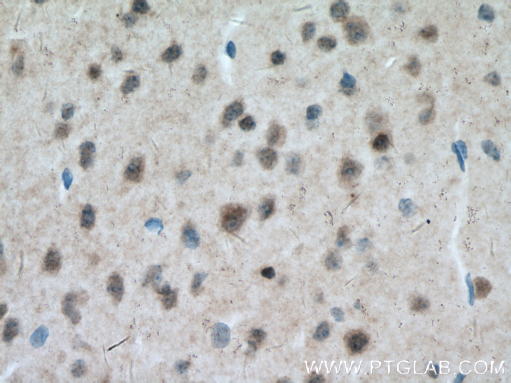 IHC staining of mouse brain using 12179-1-AP