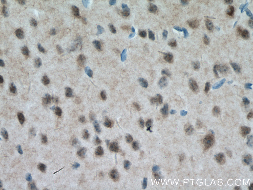 IHC staining of mouse brain using 12179-1-AP