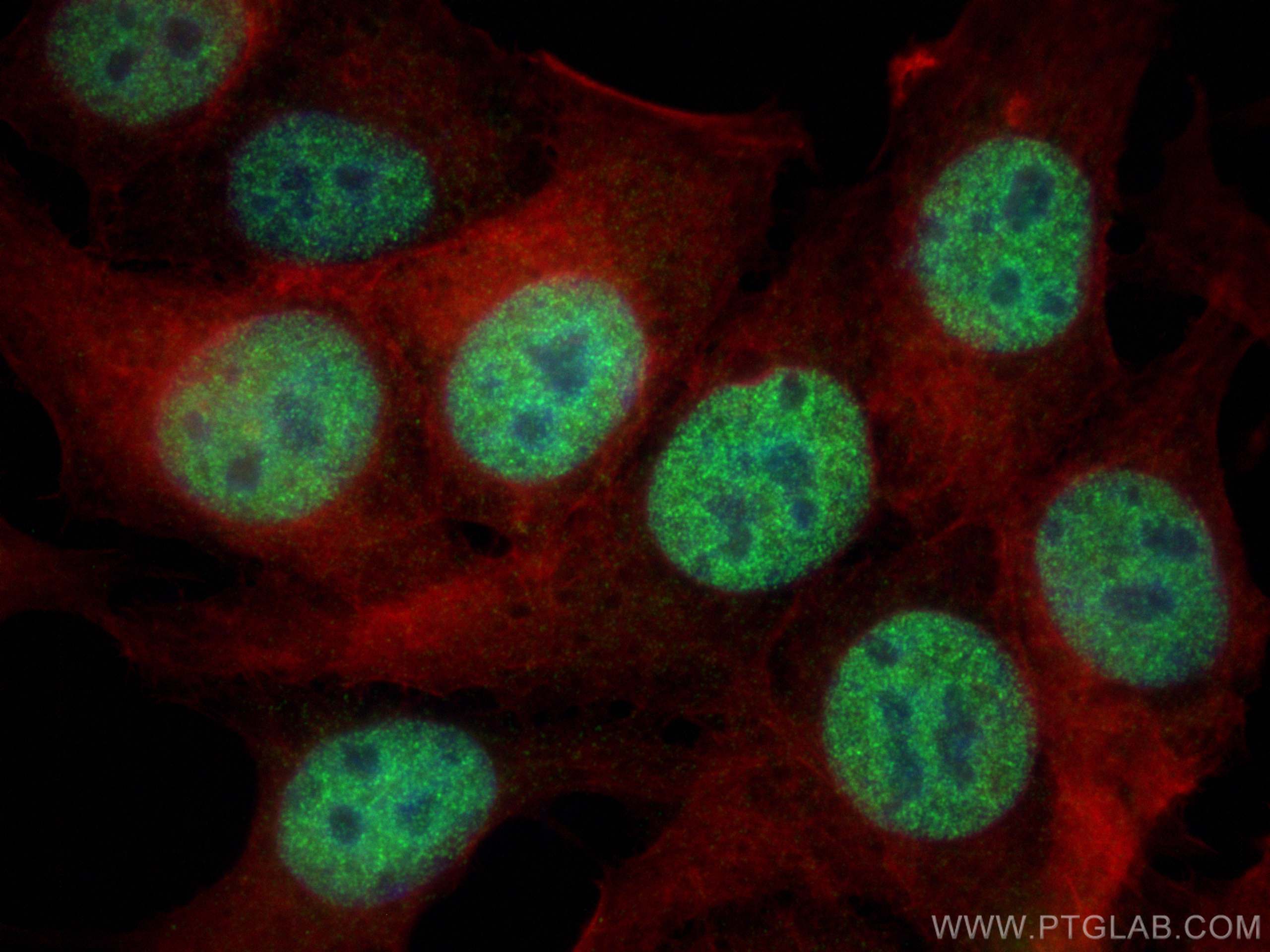 IF Staining of MCF-7 using 30545-1-AP