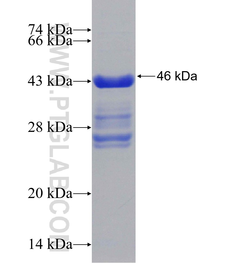 MTA1 fusion protein Ag30994 SDS-PAGE