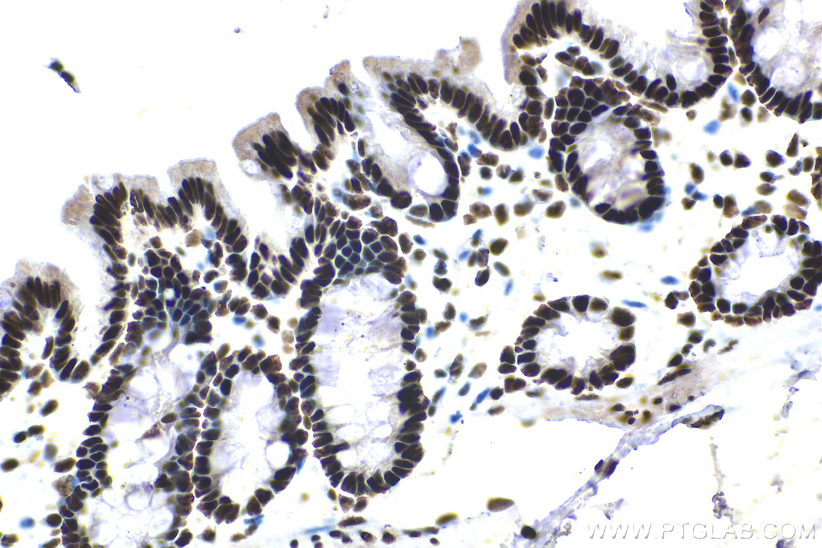 IHC staining of rat colon using 17554-1-AP