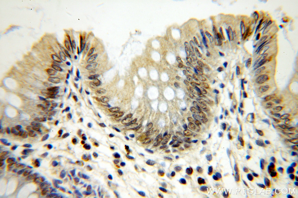 IHC staining of human colon using 17554-1-AP