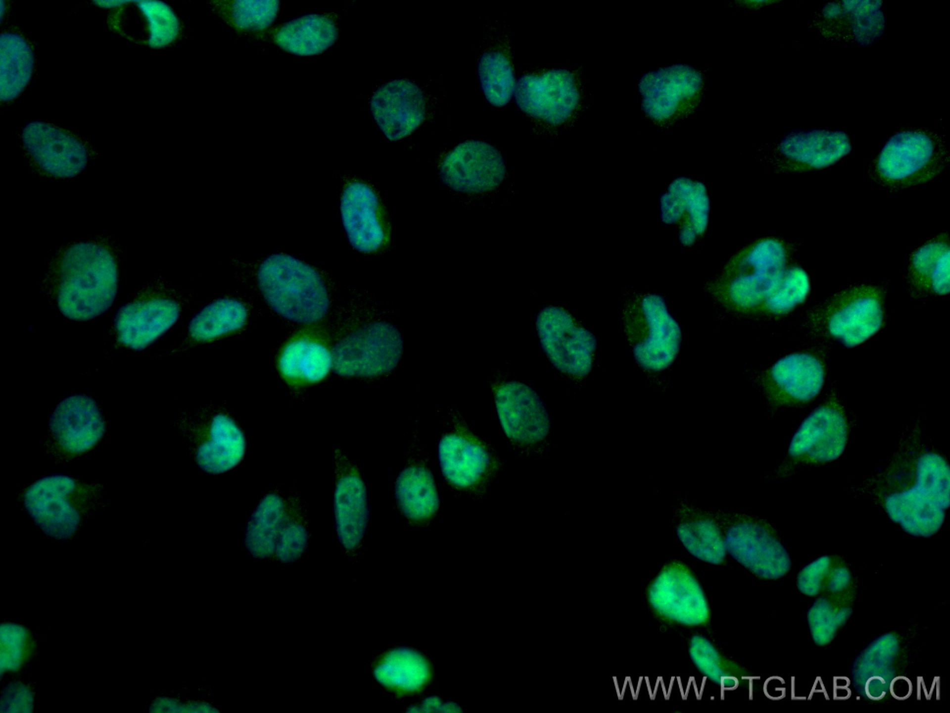 IF Staining of U-251 using 14682-1-AP