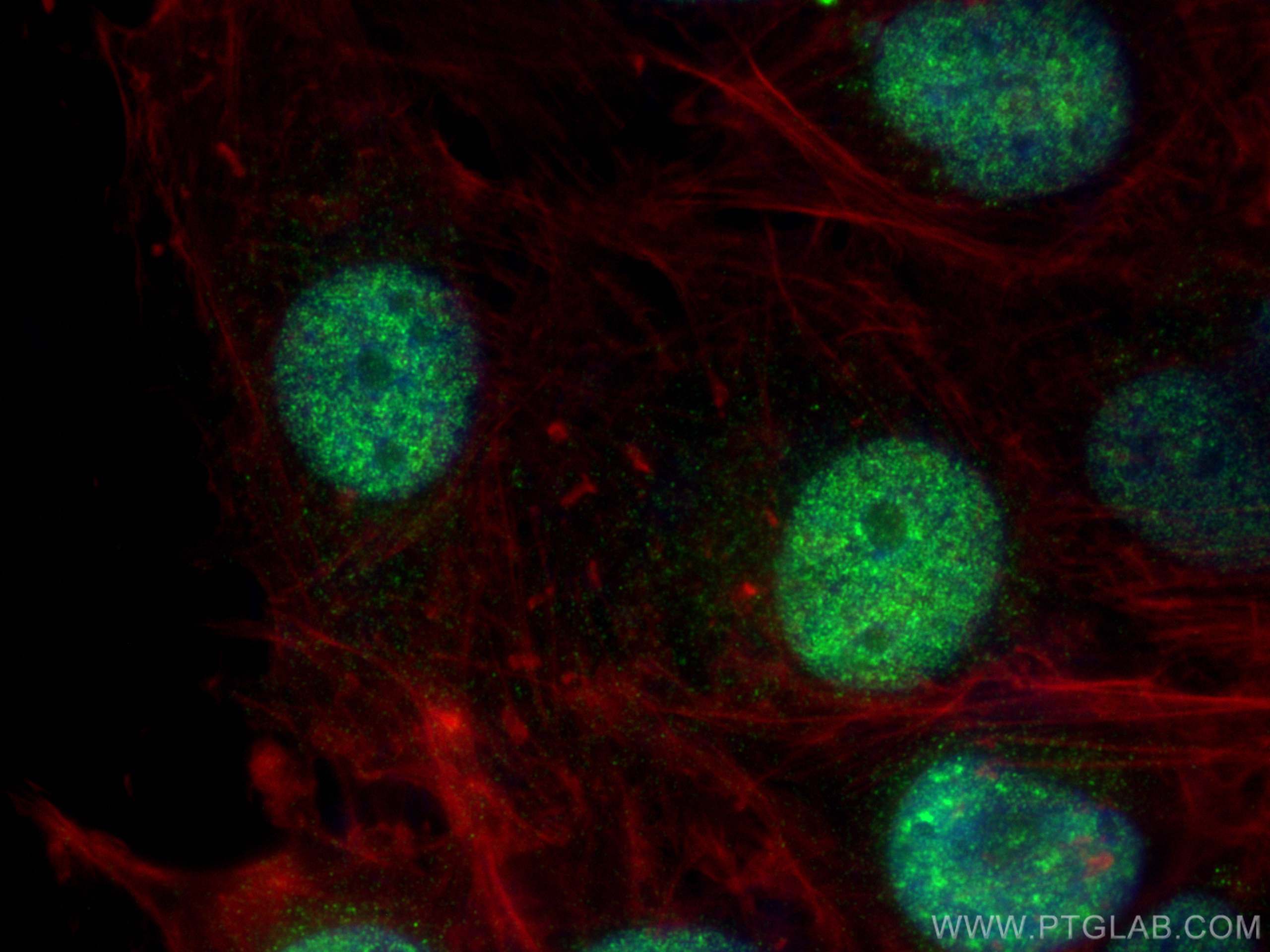 IF Staining of U-251 using 14682-1-AP