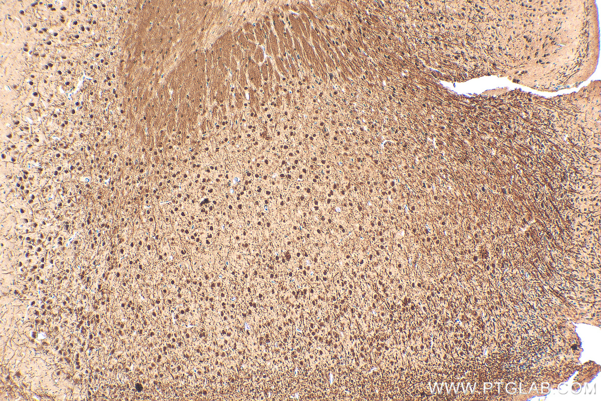 IHC staining of mouse brain using 14682-1-AP