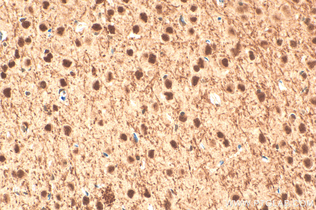 IHC staining of mouse brain using 14682-1-AP