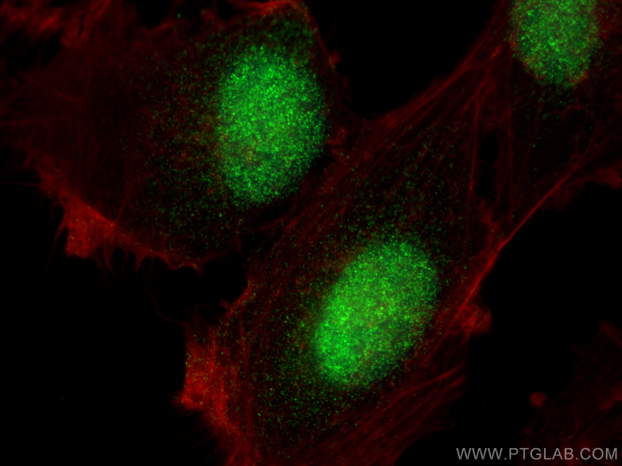 IF Staining of U-251 using 83042-3-RR (same clone as 83042-3-PBS)