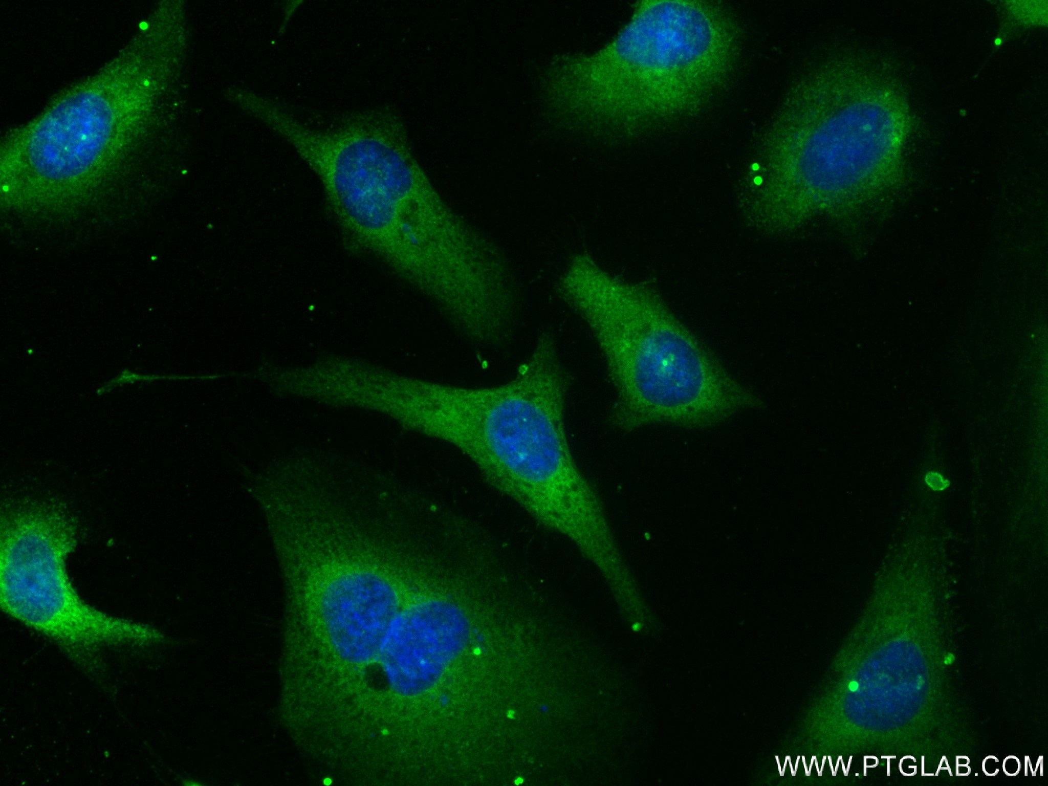 IF Staining of HeLa using 83005-5-RR