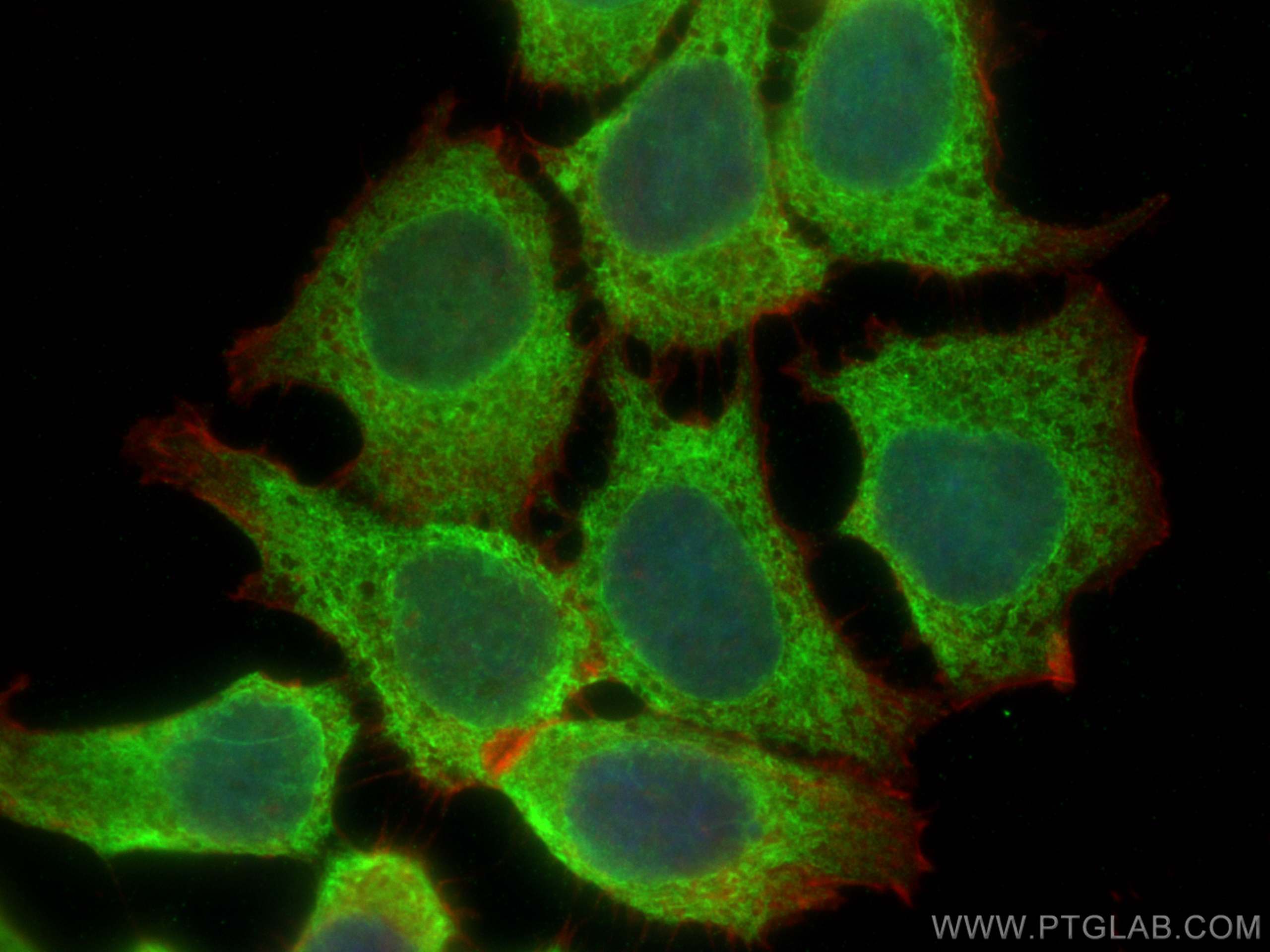 IF Staining of MCF-7 using 13860-1-AP