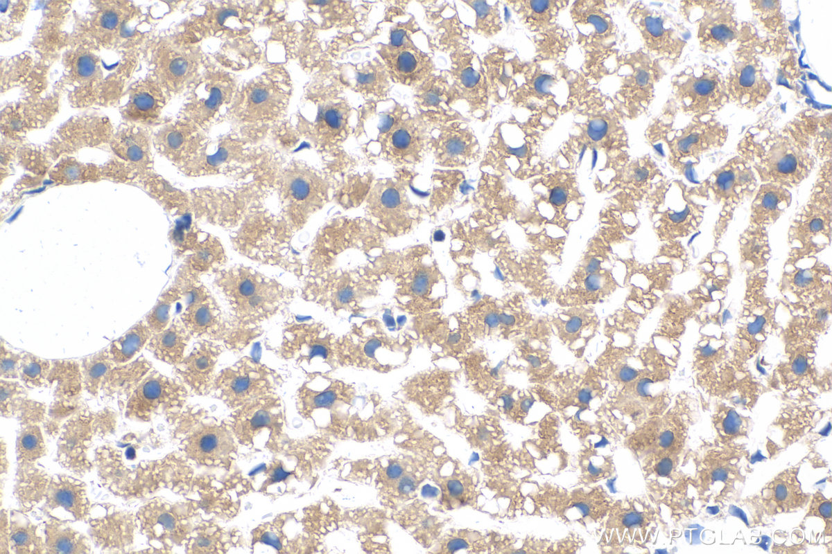 IHC staining of mouse liver using 68321-1-Ig (same clone as 68321-1-PBS)