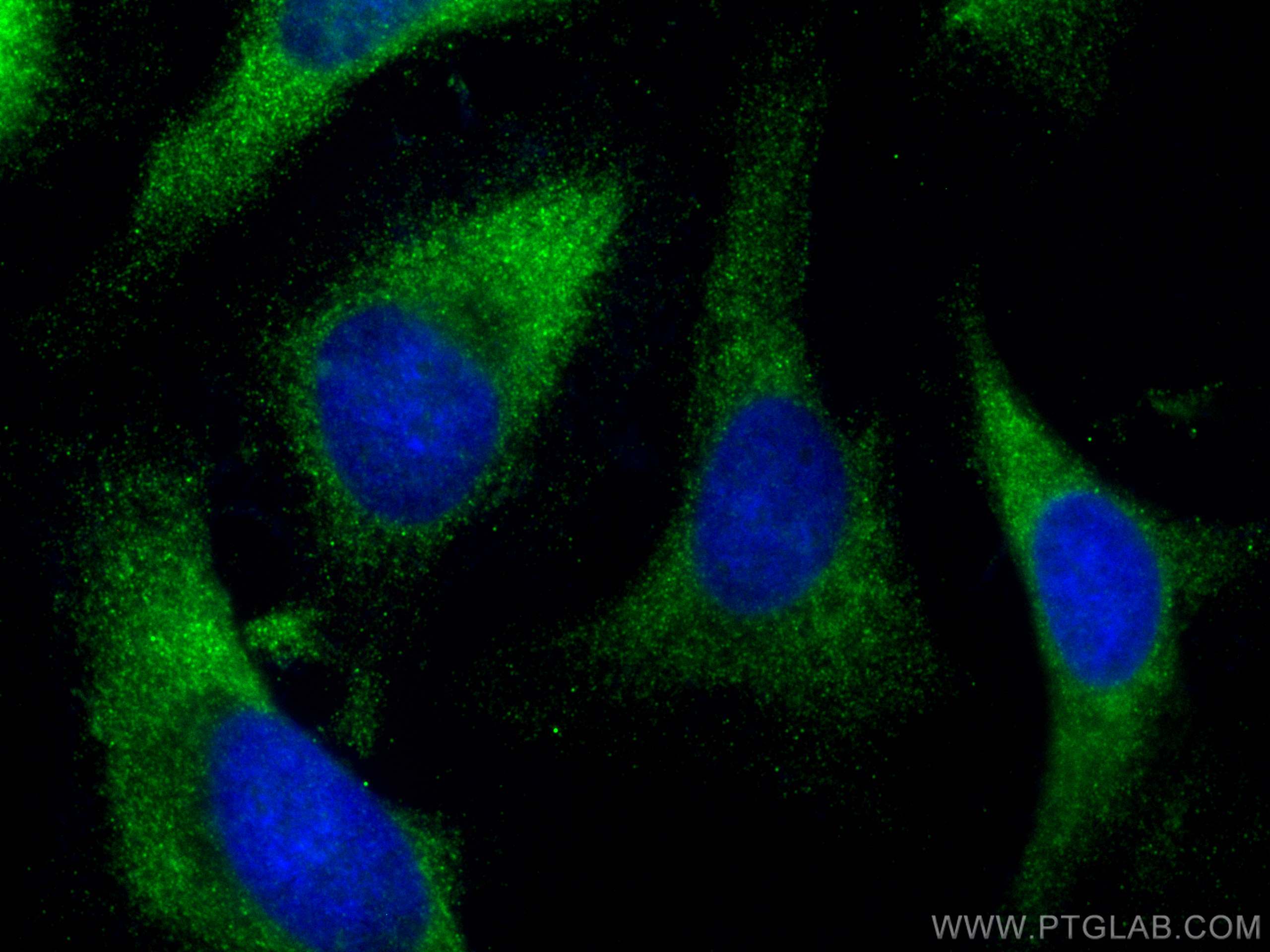 IF Staining of HeLa using 66612-1-Ig (same clone as 66612-1-PBS)