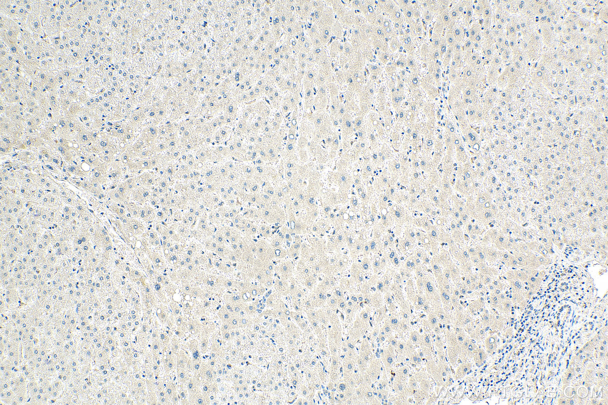 IHC staining of human liver using 66612-1-Ig (same clone as 66612-1-PBS)