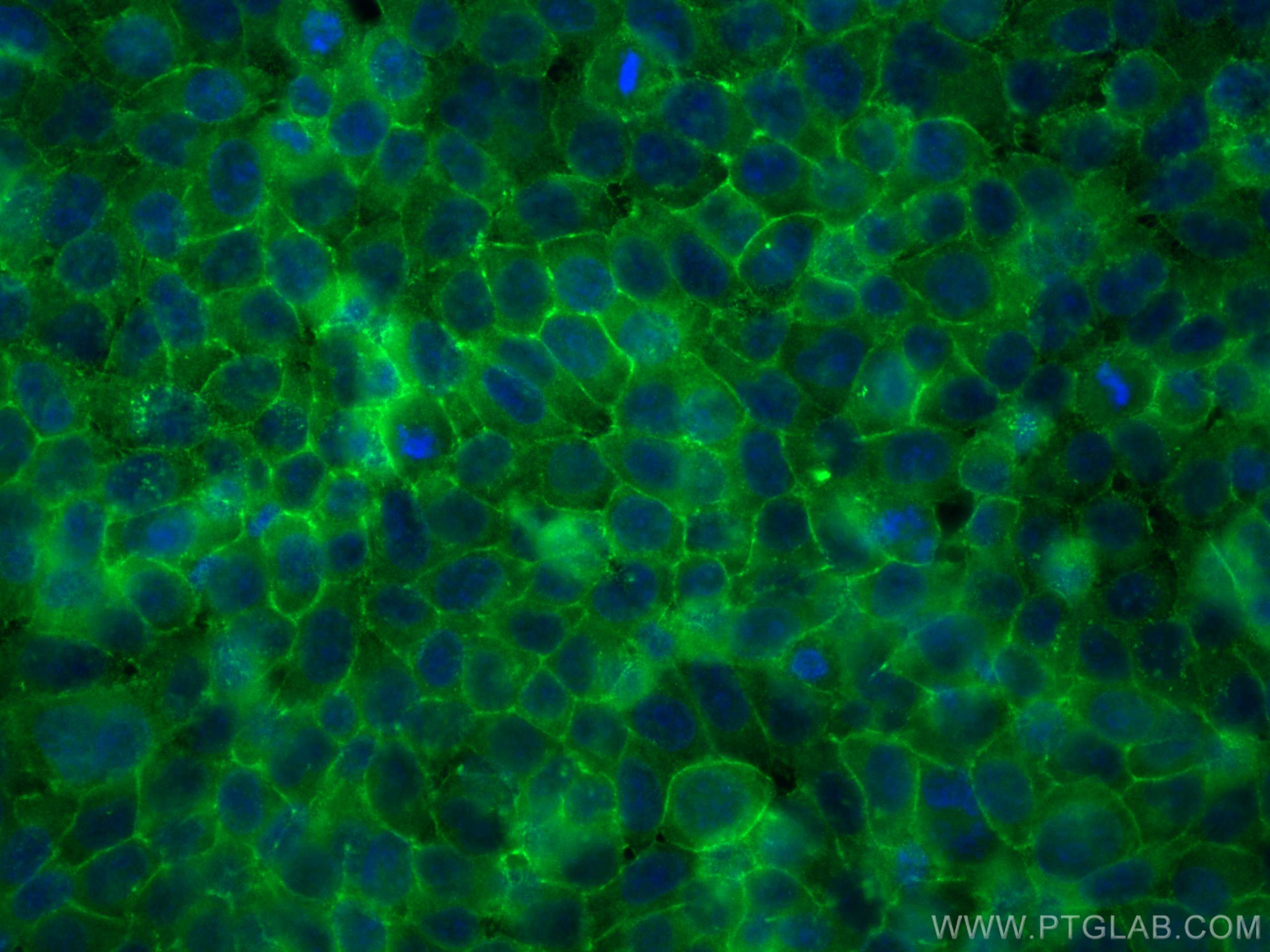 IF Staining of L02 using 13924-1-AP