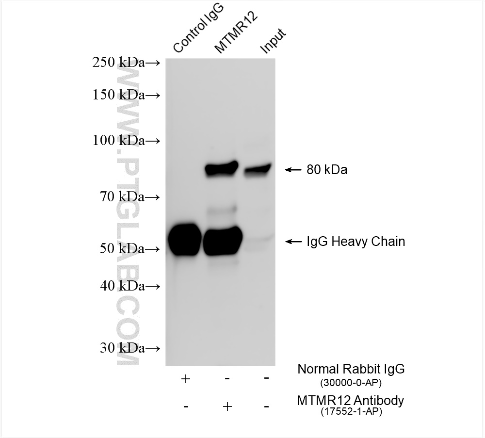 IP experiment of K-562 using 17552-1-AP