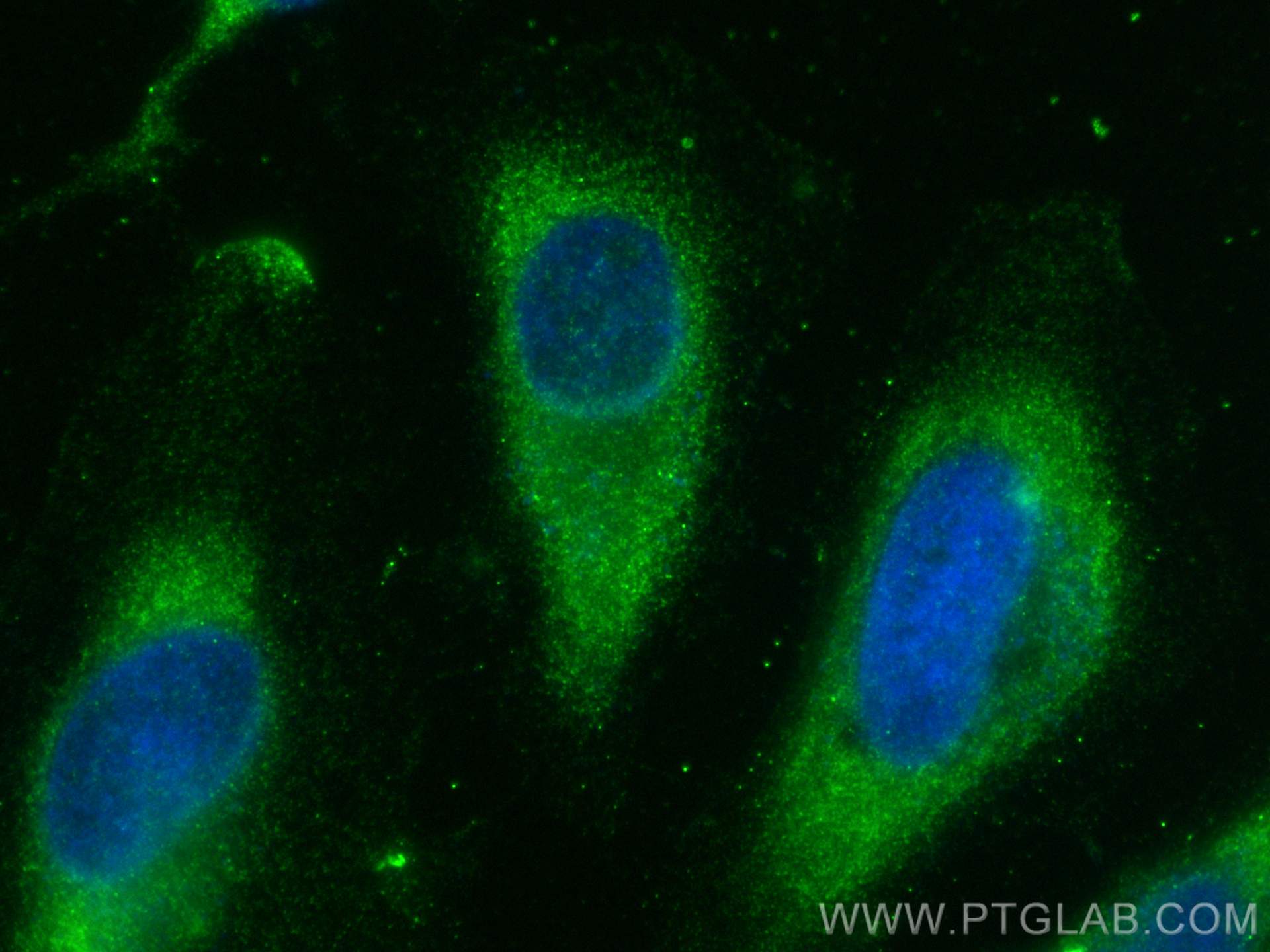 IF Staining of HeLa using 14973-1-AP