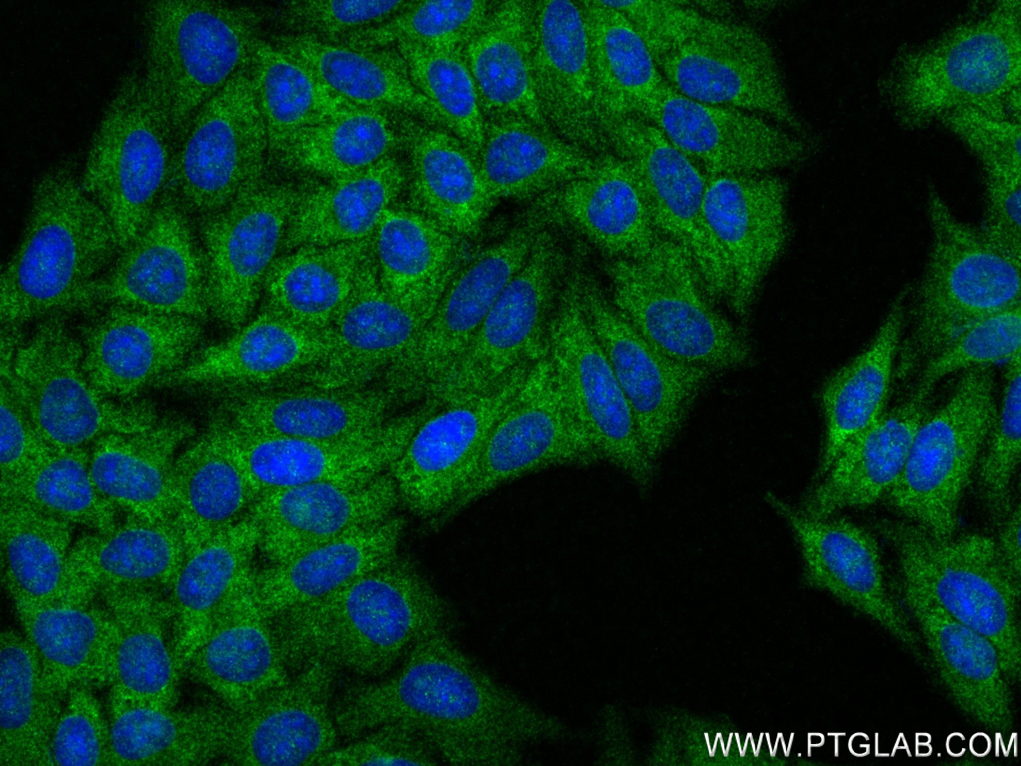 IF Staining of HepG2 using 84328-1-RR (same clone as 84328-1-PBS)