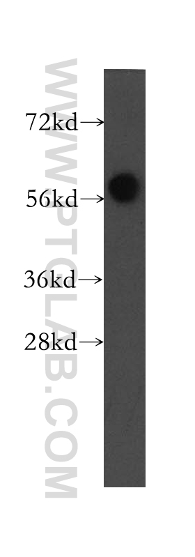 WB analysis of HeLa using 12299-1-AP