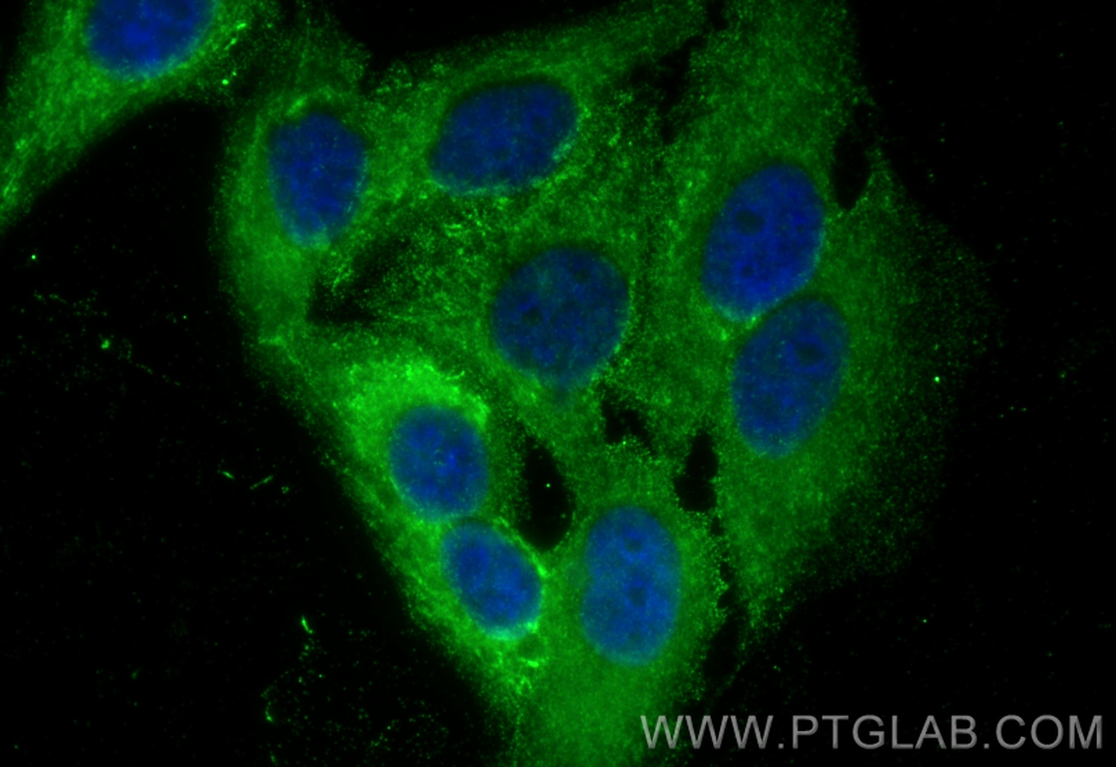 IF Staining of HepG2 using 66888-1-Ig