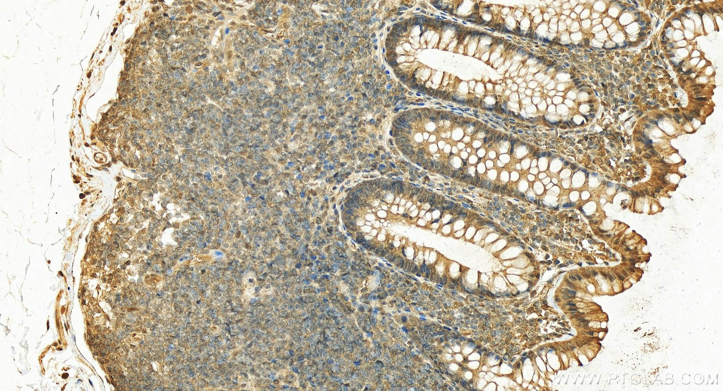 IHC staining of human normal colon using 13508-1-AP