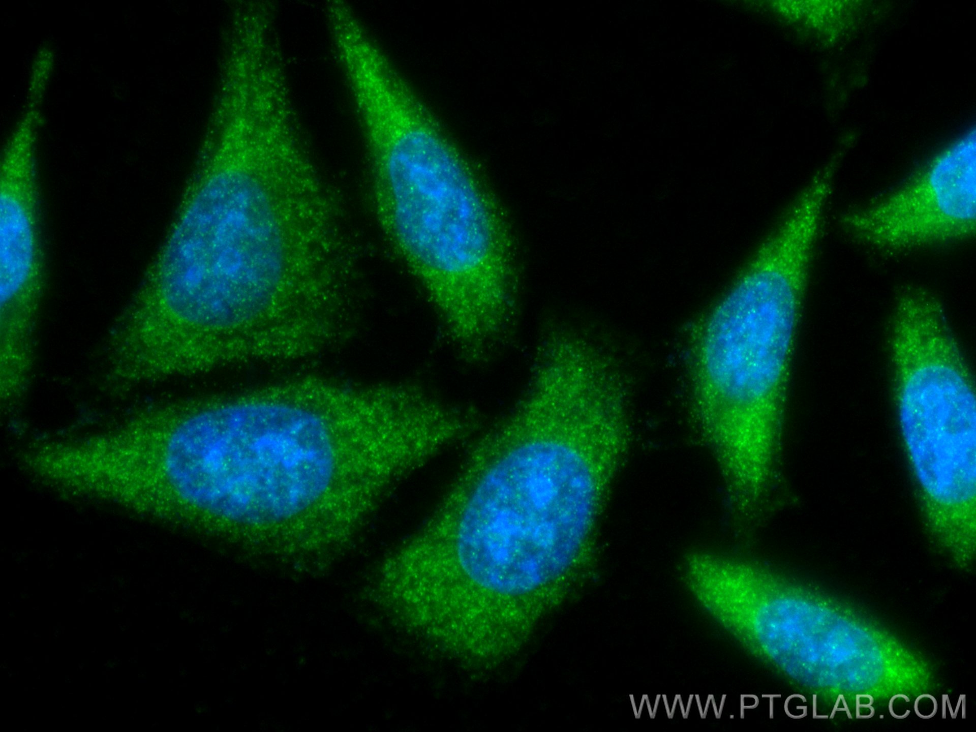 IF Staining of HepG2 using 13508-1-AP