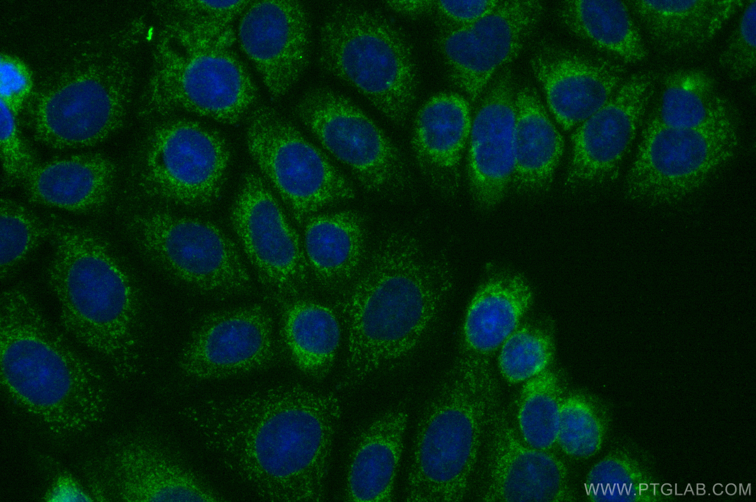 IF Staining of MCF-7 using 13995-1-AP