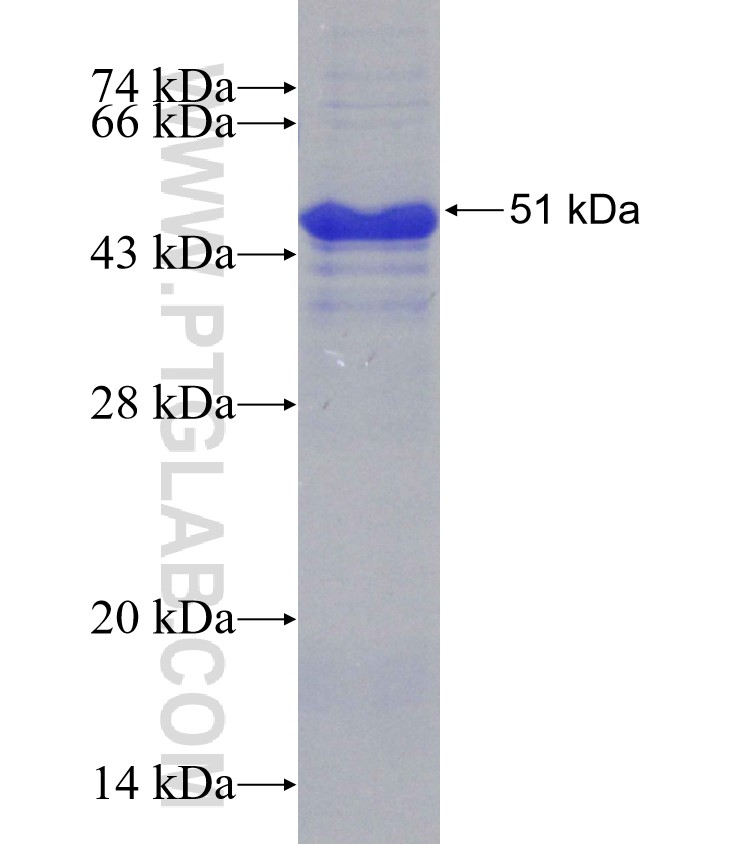 MUC13 fusion protein Ag31090 SDS-PAGE