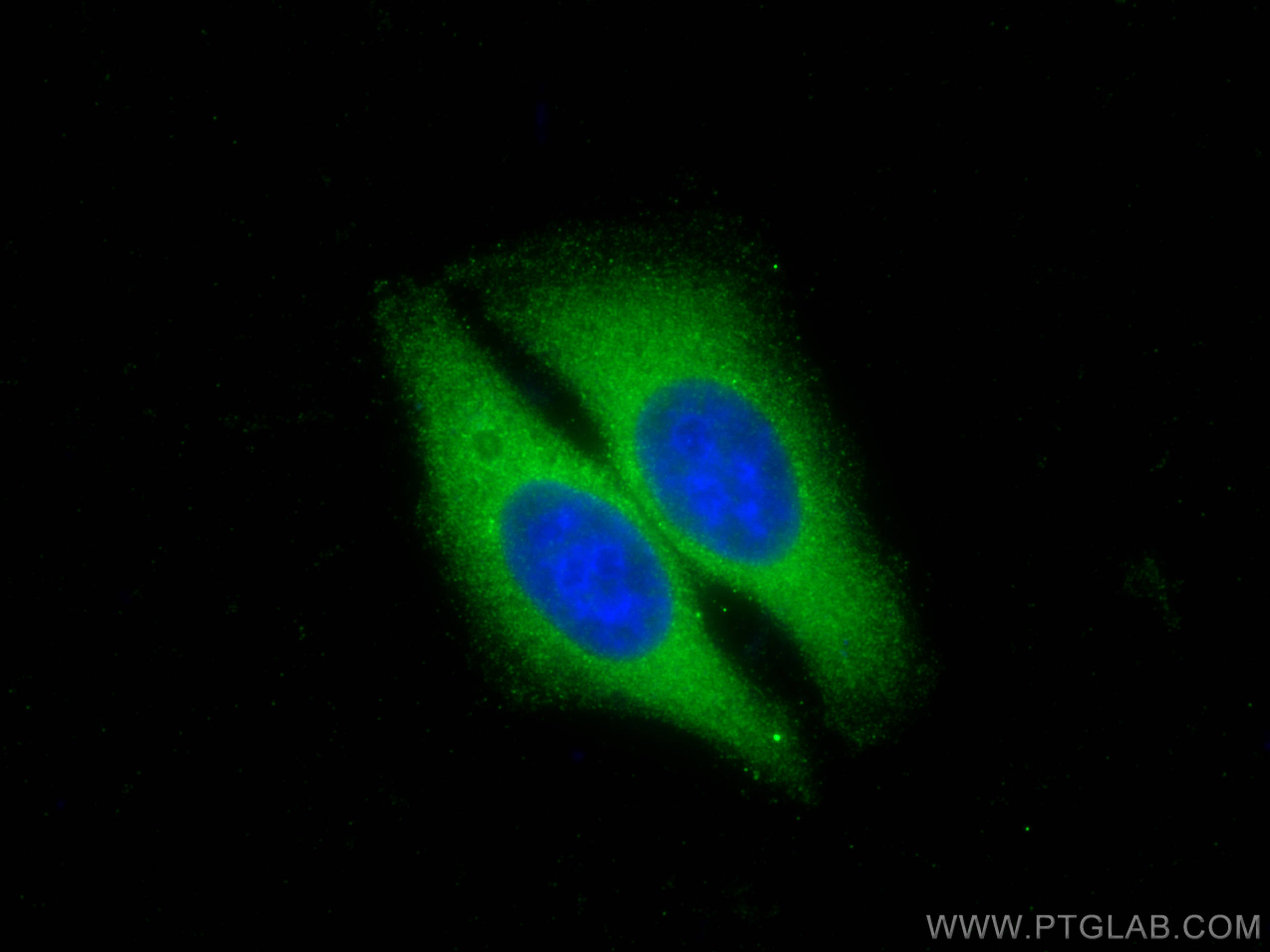 IF Staining of HepG2 using 27675-1-AP