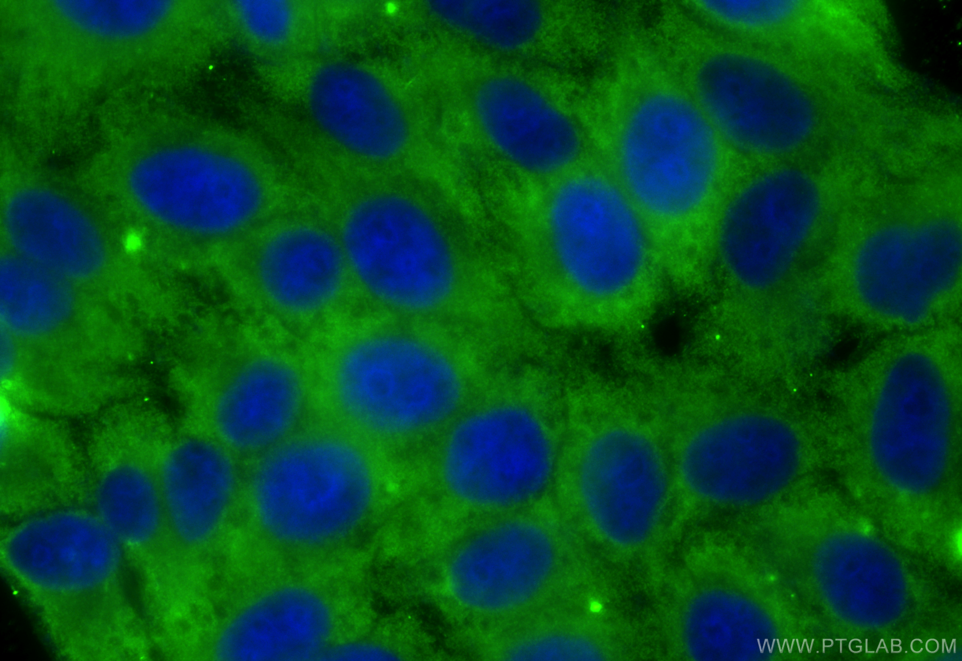 IF Staining of HepG2 using 68714-1-Ig