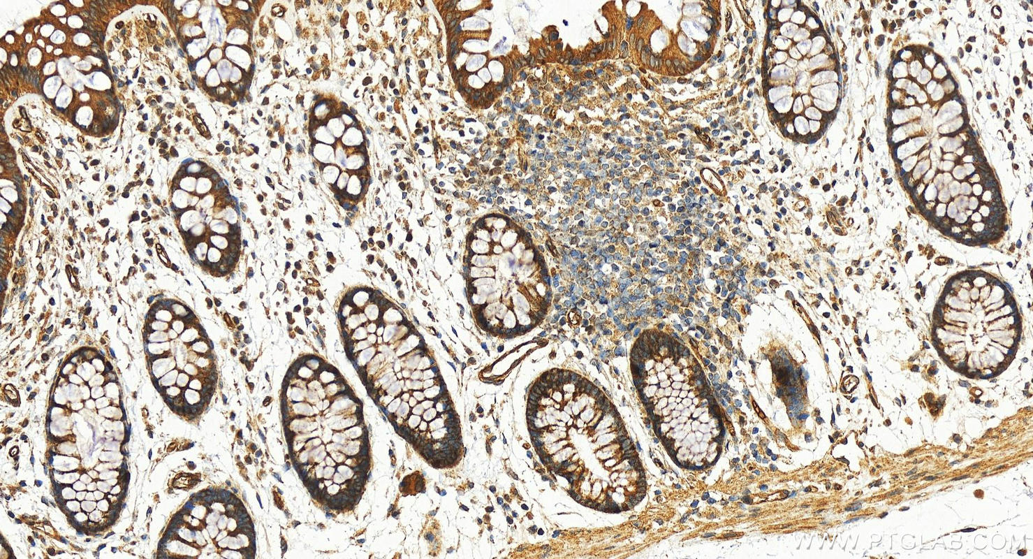 IHC staining of human colon using 28703-1-AP